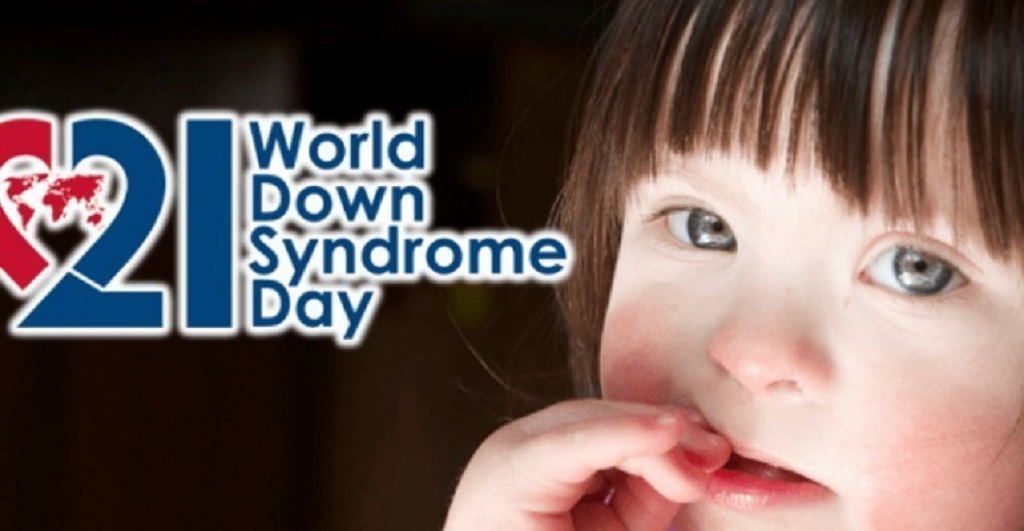 Inclusione per le persone con la sindrome di Down