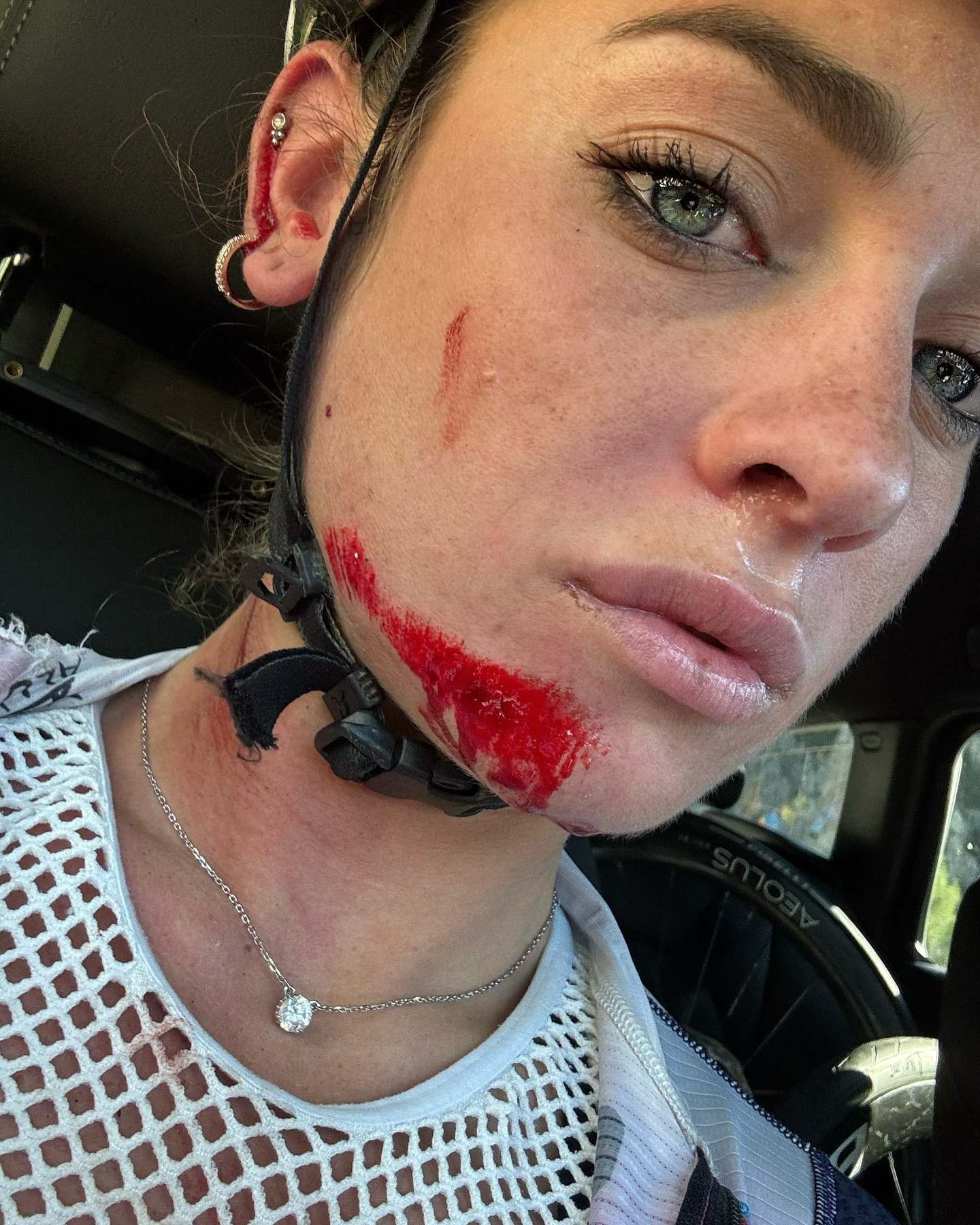 Brutta caduta per Letizia Paternoster